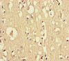 Immunohistochemistry of paraffin-embedded human brain tissue using CSB-PA846633LA01HU at dilution of 1:100 Immunohistochemistry of paraffin-embedded human brain tissue using CSB-PA846633LA01HU at dilution of 1:100