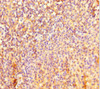 Immunohistochemistry of paraffin-embedded human tonsil tissue using CSB-PA850426LA01HU at dilution of 1:100