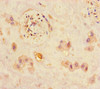 Immunohistochemistry of paraffin-embedded human placenta tissue using CSB-PA852915HA01HU at dilution of 1:100