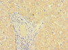 Immunohistochemistry of paraffin-embedded human liver tissue using CSB-PA853268LA01HU at dilution of 1:100