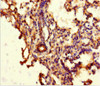 Immunohistochemistry of paraffin-embedded human lung tissue using CSB-PA875651LA01HU at dilution of 1:100