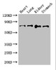 Western Blot<br />
 Positive WB detected in: Mouse heart tissue, Mouse lung tissue, Mouse kidney tissue, Mouse stomach tissue<br />
 All lanes: ABCG8 antibody at 2.8µg/ml<br />
 Secondary<br />
 Goat polyclonal to rabbit IgG at 1/50000 dilution<br />
 Predicted band size: 76 kDa<br />
 Observed band size: 76 kDa<br />