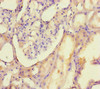 Immunohistochemistry of paraffin-embedded human kidney tissue using CSB-PA883358HA01HU at dilution of 1:100
