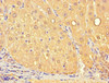 Immunohistochemistry of paraffin-embedded human liver tissue using CSB-PA883371LA01HU at dilution of 1:100