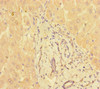 Immunohistochemistry of paraffin-embedded human liver tissue using CSB-PA892345LA01HU at dilution of 1:100 Immunohistochemistry of paraffin-embedded human liver tissue using CSB-PA892345LA01HU at dilution of 1:100
