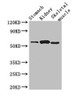 Western Blot<br />
 Positive WB detected in: Mouse stomach tissue, Mouse kidney tissue, Mouse skeletal muscle tissue<br />
 All lanes: PPM1H antibody at 3.2µg/ml<br />
 Secondary<br />
 Goat polyclonal to rabbit IgG at 1/50000 dilution<br />
 Predicted band size: 57 kDa<br />
 Observed band size: 57 kDa<br /> Western Blot<br />
 Positive WB detected in: Mouse stomach tissue, Mouse kidney tissue, Mouse skeletal muscle tissue<br />
 All lanes: PPM1H antibody at 3.2µg/ml<br />
 Secondary<br />
 Goat polyclonal to rabbit IgG at 1/50000 dilution<br />
 Predicted band size: 57 kDa<br />
 Observed band size: 57 kDa<br />