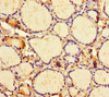 Immunohistochemistry of paraffin-embedded human thyroid tissue using CSB-PA897466LA01HU at dilution of 1:100