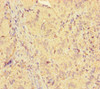 Immunohistochemistry of paraffin-embedded human adrenal gland tissue using CSB-PA897466LA01HU at dilution of 1:100