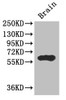 Western Blot<br />
 Positive WB detected in: Mouse brain tissue<br />
 All lanes: ICE1 antibody at 2.7µg/ml<br />
 Secondary<br />
 Goat polyclonal to rabbit IgG at 1/50000 dilution<br />
 Predicted band size: 68 kDa<br />
 Observed band size: 68 kDa<br />
