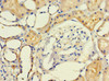 Immunohistochemistry of paraffin-embedded human kidney tissue using CSB-PA897471LA01HU at dilution of 1:100