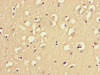 Immunohistochemistry of paraffin-embedded human brain tissue using CSB-PA897529LA01HU at dilution of 1:100