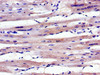 Immunohistochemistry of paraffin-embedded human heart tissue using CSB-PA001107LA01HU at dilution of 1:100