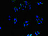 Immunofluorescent analysis of HepG2 cells using CSB-PA001107LA01HU at dilution of 1:100 and Alexa Fluor 488-congugated AffiniPure Goat Anti-Rabbit IgG (H+L)