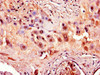 Immunohistochemistry of paraffin-embedded human placenta tissue using CSB-PA001275LA01HU at dilution of 1:100