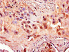 Immunohistochemistry of paraffin-embedded human placenta tissue using CSB-PA001275LA01HU at dilution of 1:100 Immunohistochemistry of paraffin-embedded human placenta tissue using CSB-PA001275LA01HU at dilution of 1:100