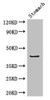 Western Blot<br />
 Positive WB detected in: Mouse stomach tissue<br />
 All lanes: ADRM1 antibody at 2.7µg/ml<br />
 Secondary<br />
 Goat polyclonal to rabbit IgG at 1/50000 dilution<br />
 Predicted band size: 43 kDa<br />
 Observed band size: 43 kDa<br />