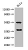 Western Blot<br />
 Positive WB detected in: Hela whole cell lysate<br />
 All lanes: AKR1B1 antibody at 3µg/ml<br />
 Secondary<br />
 Goat polyclonal to rabbit IgG at 1/50000 dilution<br />
 Predicted band size: 36 kDa<br />
 Observed band size: 36, 50 kDa<br />