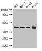 Western Blot<br />
 Positive WB detected in: PC-3 whole cell lysate, MCF-7 whole cell lysate, HepG2 whole cell lysate, Mouse brain tissue<br />
 All lanes: AMACR antibody at 3µg/ml<br />
 Secondary<br />
 Goat polyclonal to rabbit IgG at 1/50000 dilution<br />
 Predicted band size: 43, 26, 23, 44 kDa<br />
 Observed band size: 43 kDa<br />