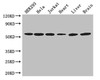 Western Blot<br />
 Positive WB detected in: HEK293 whole cell lysate, Hela whole cell lysate, Jurkat whole cell lysate, Mouse heart tissue, Mouse liver tissue, Mouse brain tissue<br />
 All lanes: ARIH2 antibody at 3µg/ml<br />
 Secondary<br />
 Goat polyclonal to rabbit IgG at 1/50000 dilution<br />
 Predicted band size: 58 kDa<br />
 Observed band size: 58 kDa<br />