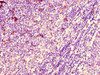 Immunohistochemistry of paraffin-embedded human lymph node tissue using CSB-PA002069LA01HU at dilution of 1:100