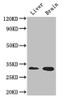 Western Blot<br />
 Positive WB detected in: Mouse liver tissue, Mouse brain tissue<br />
 All lanes: CD37 antibody at 2.7µg/ml<br />
 Secondary<br />
 Goat polyclonal to rabbit IgG at 1/50000 dilution<br />
 Predicted band size: 32, 24, 23 kDa<br />
 Observed band size: 32 kDa<br />