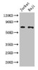 Western Blot<br />
 Positive WB detected in: Jurkat whole cell lysate, Raji whole cell lysate<br />
 All lanes: CDC25B antibody at 3µg/ml<br />
 Secondary<br />
 Goat polyclonal to rabbit IgG at 1/50000 dilution<br />
 Predicted band size: 65, 64, 61, 68 kDa<br />
 Observed band size: 65 kDa<br />