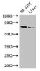 Western Blot<br />
 Positive WB detected in: SH-SY5Y whole cell lysate, Mouse liver tissue<br />
 All lanes: CHAT antibody at 3µg/ml<br />
 Secondary<br />
 Goat polyclonal to rabbit IgG at 1/50000 dilution<br />
 Predicted band size: 83, 75, 71 kDa<br />
 Observed band size: 75 kDa<br />