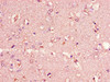 Immunohistochemistry of paraffin-embedded human brain tissue using CSB-PA005431LA01HU at dilution of 1:100