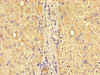 Immunohistochemistry of paraffin-embedded human liver tissue using CSB-PA005490LA01HU at dilution of 1:100