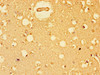 Immunohistochemistry of paraffin-embedded human brain tissue using CSB-PA007556LA01HU at dilution of 1:100