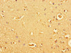 Immunohistochemistry of paraffin-embedded human brain tissue using CSB-PA010053LA01HU at dilution of 1:100