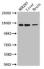 Western Blot<br />
 Positive WB detected in: HEK293 whole cell lysate, Mouse liver tissue, Mouse brain tissue<br />
 All lanes: GUCY2C antibody at 3.4µg/ml<br />
 Secondary<br />
 Goat polyclonal to rabbit IgG at 1/50000 dilution<br />
 Predicted band size: 124 kDa<br />
 Observed band size: 124 kDa<br />