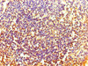 Immunohistochemistry of paraffin-embedded human tonsil tissue using CSB-PA010652LA01HU at dilution of 1:100