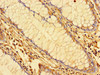 Immunohistochemistry of paraffin-embedded human colon tissue using CSB-PA012484LA01HU at dilution of 1:100