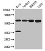 Western Blot<br />
 Positive WB detected in: Raji whole cell lysate, Jurkat whole cell lysate, HEK293 whole cell lysate, U251 whole cell lysate<br />
 All lanes: KPNA2 antibody at 3µg/ml<br />
 Secondary<br />
 Goat polyclonal to rabbit IgG at 1/50000 dilution<br />
 Predicted band size: 58 kDa<br />
 Observed band size: 58 kDa<br />