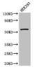 Western Blot<br />
 Positive WB detected in: HEK293 whole cell lysate<br />
 All lanes: MLYCD antibody at 2.7µg/ml<br />
 Secondary<br />
 Goat polyclonal to rabbit IgG at 1/50000 dilution<br />
 Predicted band size: 56, 51 kDa<br />
 Observed band size: 56 kDa<br /> Western Blot<br />
 Positive WB detected in: HEK293 whole cell lysate<br />
 All lanes: MLYCD antibody at 2.7µg/ml<br />
 Secondary<br />
 Goat polyclonal to rabbit IgG at 1/50000 dilution<br />
 Predicted band size: 56, 51 kDa<br />
 Observed band size: 56 kDa<br />