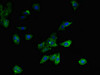 Immunofluorescent analysis of HepG2 cells using CSB-PA014646LA01HU at dilution of 1:100 and Alexa Fluor 488-congugated AffiniPure Goat Anti-Rabbit IgG (H+L) Immunofluorescent analysis of HepG2 cells using CSB-PA014646LA01HU at dilution of 1:100 and Alexa Fluor 488-congugated AffiniPure Goat Anti-Rabbit IgG (H+L)