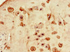 Immunohistochemistry of paraffin-embedded human placenta tissue using CSB-PA020614LA01HU at dilution of 1:100