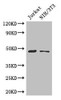 Western Blot<br />
 Positive WB detected in: Jurkat whole cell lysate, NIH/3T3 whole cell lysate<br />
 All lanes: SGK1 antibody at 3µg/ml<br />
 Secondary<br />
 Goat polyclonal to rabbit IgG at 1/50000 dilution<br />
 Predicted band size: 49, 60, 51, 48, 53 kDa<br />
 Observed band size: 49 kDa<br />