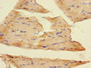 Immunohistochemistry of paraffin-embedded human skeletal muscle tissue using CSB-PA021610LA01HU at dilution of 1:100