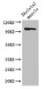 Western Blot<br />
 Positive WB detected in: Mouse skeletal muscle tissue<br />
 All lanes: SLFN11 antibody at 2.8µg/ml<br />
 Secondary<br />
 Goat polyclonal to rabbit IgG at 1/50000 dilution<br />
 Predicted band size: 103 kDa<br />
 Observed band size: 103 kDa<br />