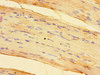 Immunohistochemistry of paraffin-embedded human skeletal muscle tissue using CSB-PA022564LA01HU at dilution of 1:100