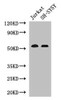 Western Blot<br />
 Positive WB detected in: Jurkat whole cell lysate, SH-SY5Y whole cell lysate<br />
 All lanes: TGFBR1 antibody at 4µg/ml<br />
 Secondary<br />
 Goat polyclonal to rabbit IgG at 1/50000 dilution<br />
 Predicted band size: 56, 57, 48 kDa<br />
 Observed band size: 56 kDa<br />