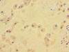 Immunohistochemistry of paraffin-embedded human placenta tissue using CSB-PA023452LA01HU at dilution of 1:100