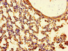 Immunohistochemistry of paraffin-embedded human lung tissue using CSB-PA025265LA01HU at dilution of 1:100