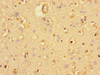 Immunohistochemistry of paraffin-embedded human brain tissue using CSB-PA025420LA01HU at dilution of 1:100