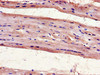 Immunohistochemistry of paraffin-embedded human heart tissue using CSB-PA025641LA01HU at dilution of 1:100