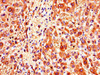 Immunohistochemistry of paraffin-embedded human liver tissue using CSB-PA026504LA01HU at dilution of 1:100