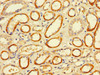 Immunohistochemistry of paraffin-embedded human kidney tissue using CSB-PA04459A0Rb at dilution of 1:100