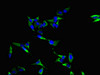 Immunofluorescent analysis of Hela cells using CSB-PA04629A0Rb at dilution of 1:100 and Alexa Fluor 488-congugated AffiniPure Goat Anti-Rabbit IgG (H+L)